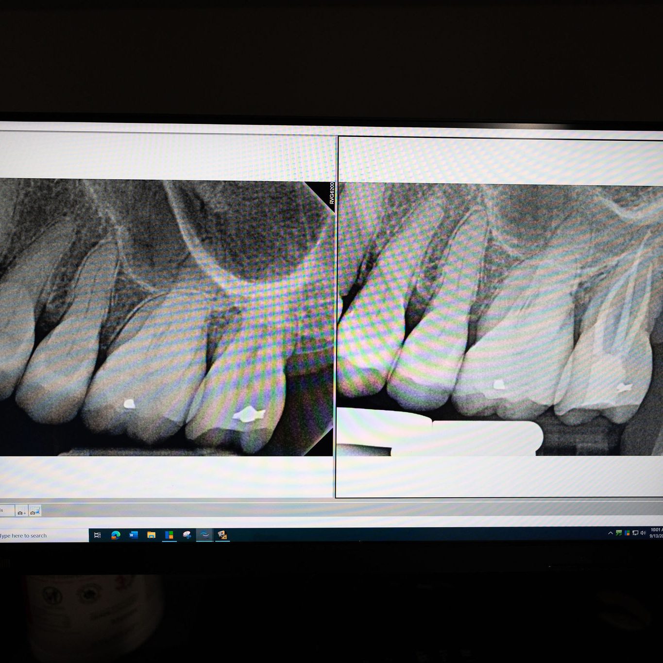 EndodonticCenter2024-106 EndodonticCenter2024-106